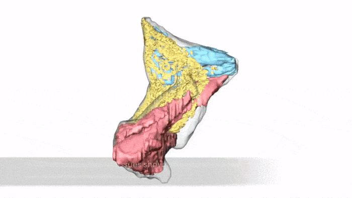 medical images of new salivary glands 